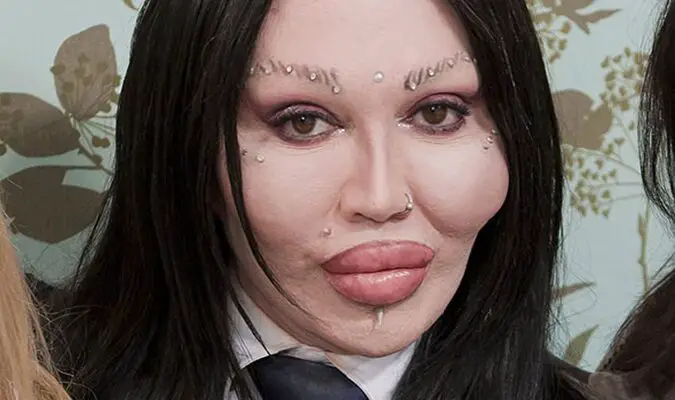 pete burns after.jpg